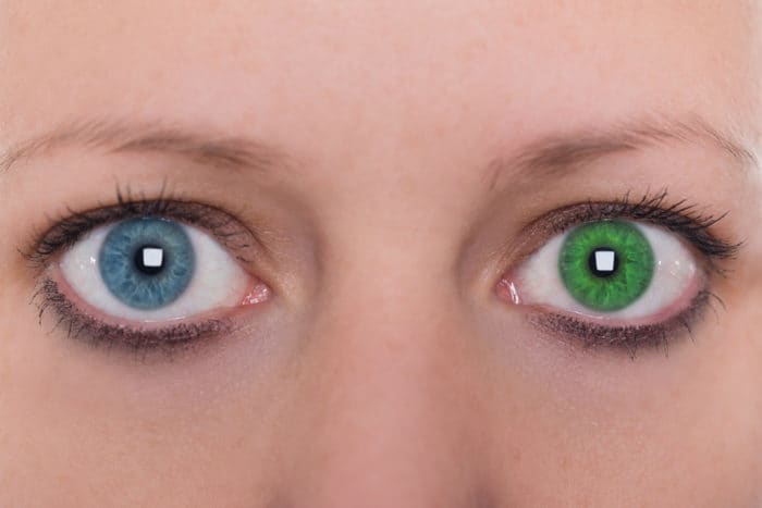 forskjellige farger av heterochromia