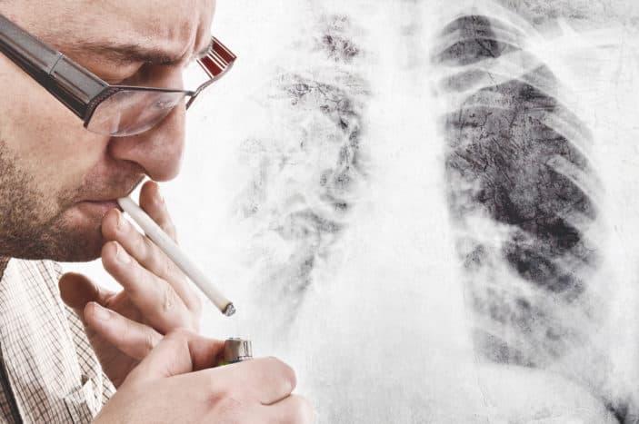 symptomer på lungekreft