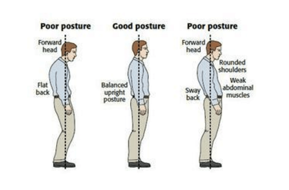 Bildekilde: http://www.thephysiocompany.com/blog/stop-slouching-postural-dysfunction-symptoms-causes-and-behandeling-of-bad-posture