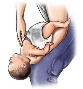 Trinn for å hjelpe choking babyer (4-5) kilde: www.webmd.com