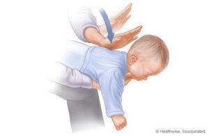 Fremgangsmåte for å hjelpe kvelende babyer (1-3) kilder: www.webmd.com