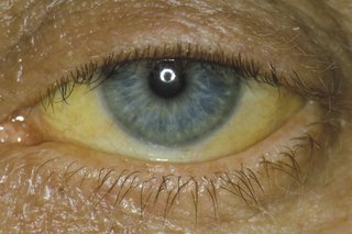 gule øyne