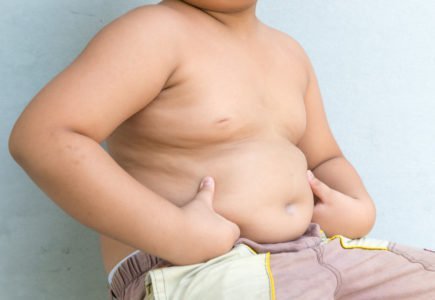 fedme hos barn