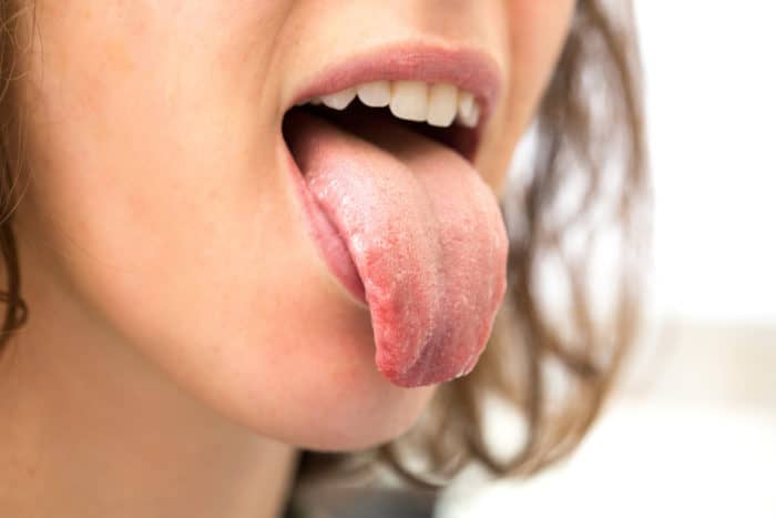 årsaken til tunge kløe