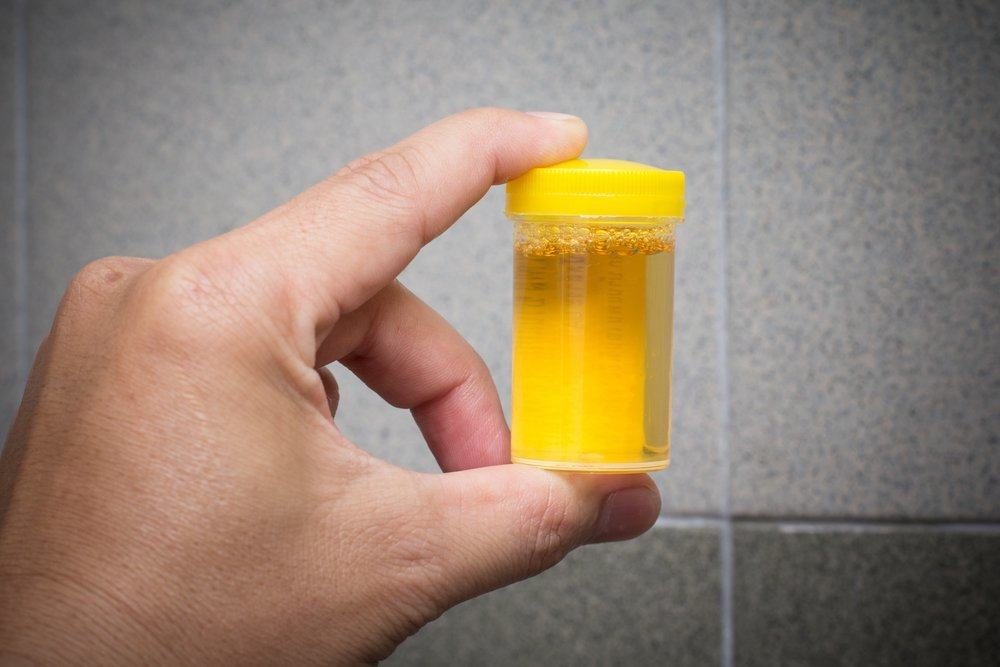 urinterapi for å drikke urin