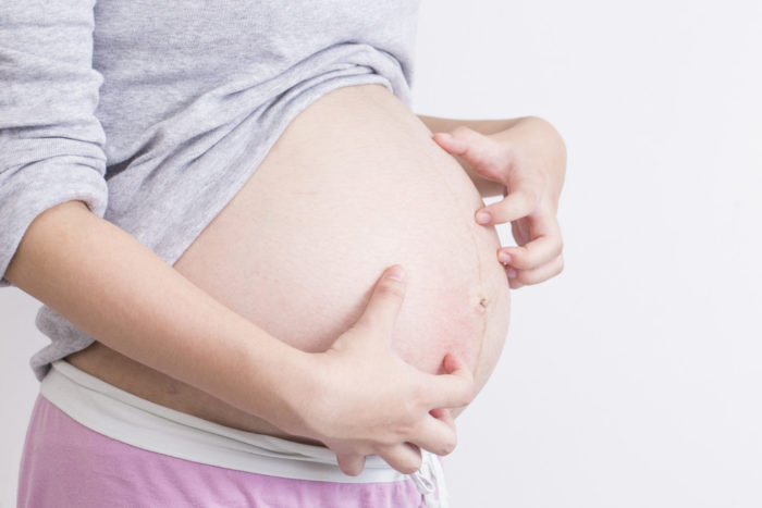 Pruritic folliculitis er årsaken til kløende hud under graviditet