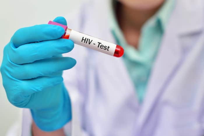 HIV blodprøve