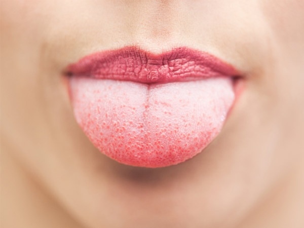 fargen på tungen betyr sykdom